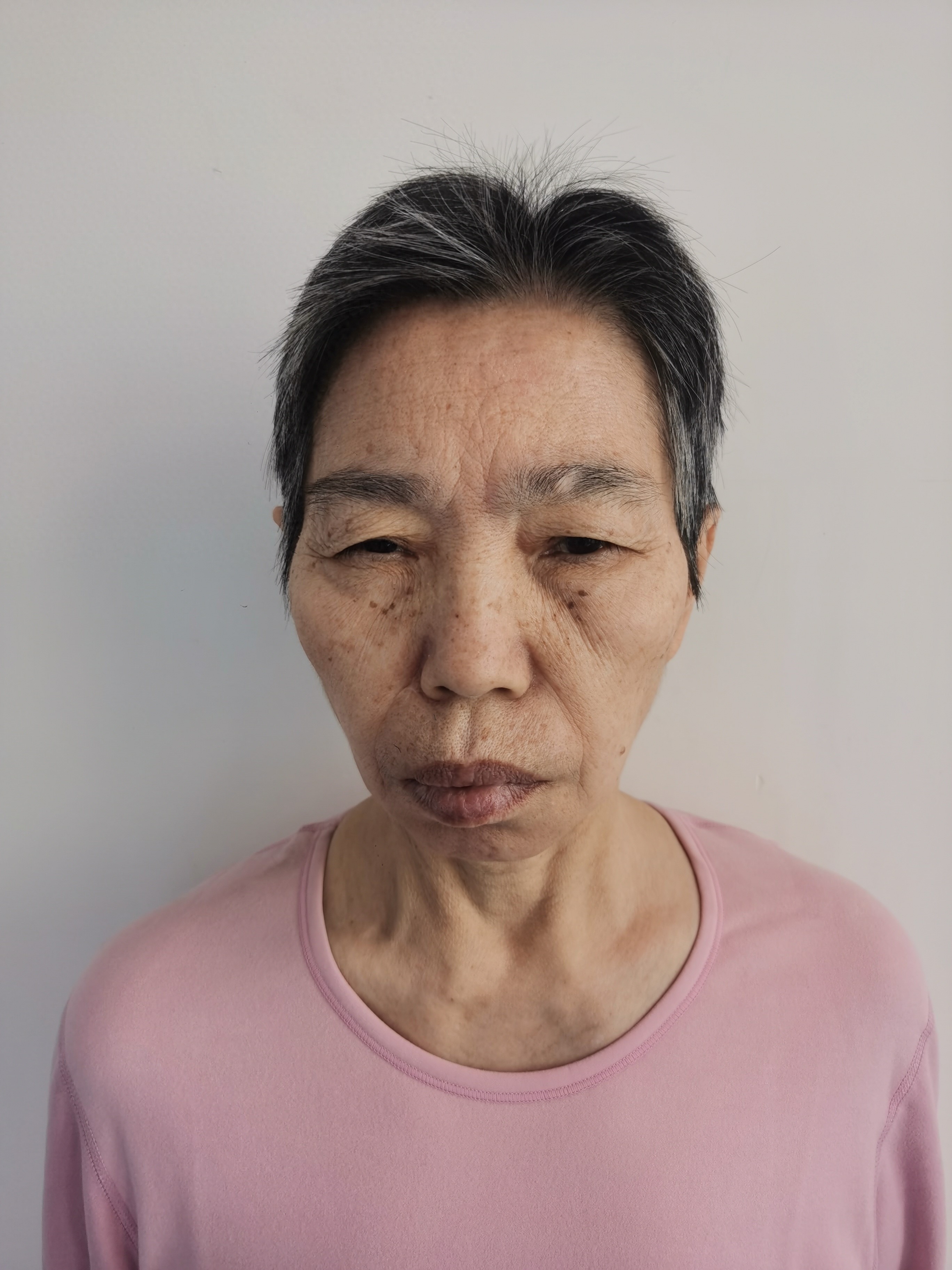 走失者照片 北京市寻亲：五旬女子被救助，自述叫...
