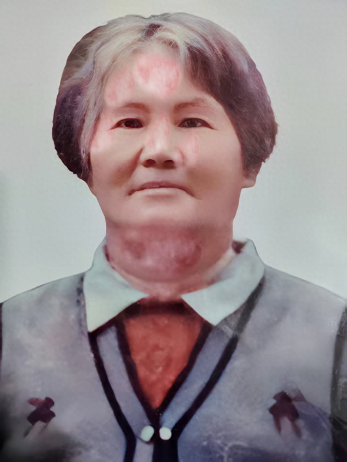 走失者照片 哈密市寻人：八旬老太走失，面部有白...