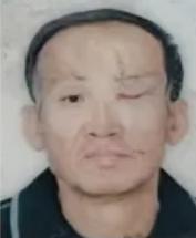 走失者照片 沧州市寻人：六旬老人走失，左眼失明...