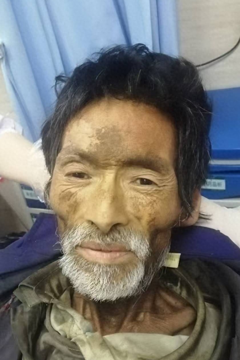 走失者照片 岳阳市寻亲：六旬老人被救助，穿蓝色...