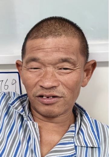 走失者照片 中山市中山市寻亲：中年男子被救助，...