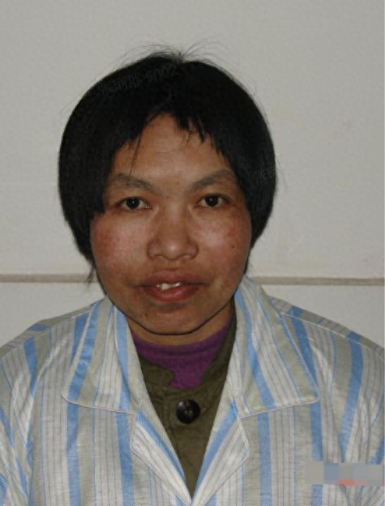走失者照片 晋中市寻亲：中年女子被救助，疑患智...