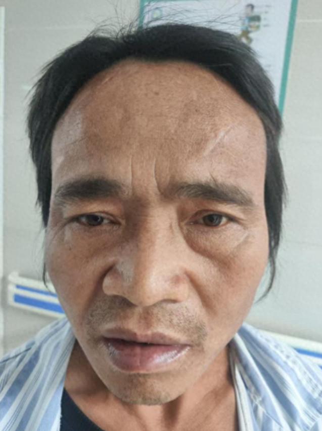 走失者照片 郑州市寻亲：中年男子被救助，高1米...