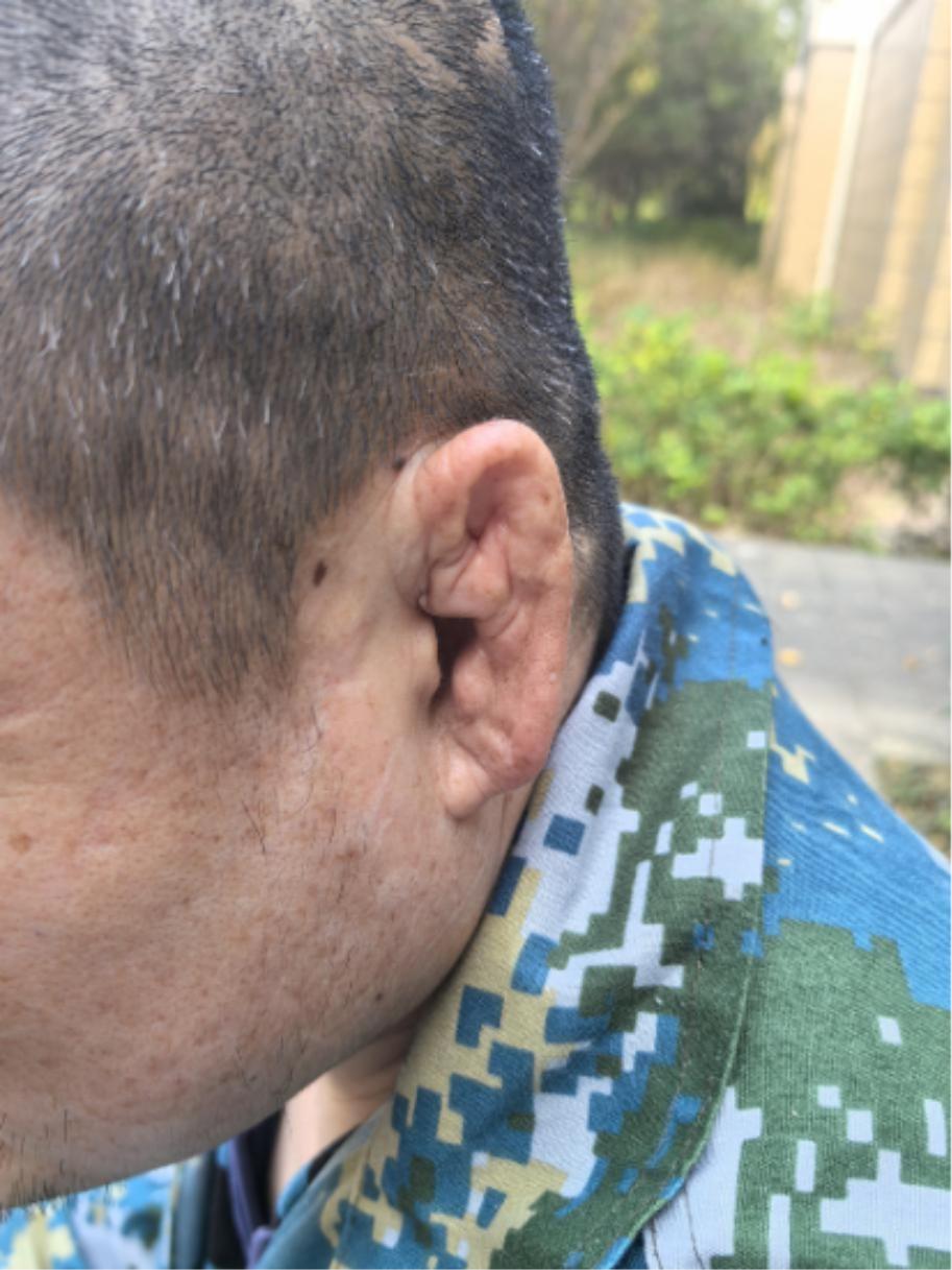 走失者照片 蚌埠市寻亲：六旬老人被救助，自述姓...