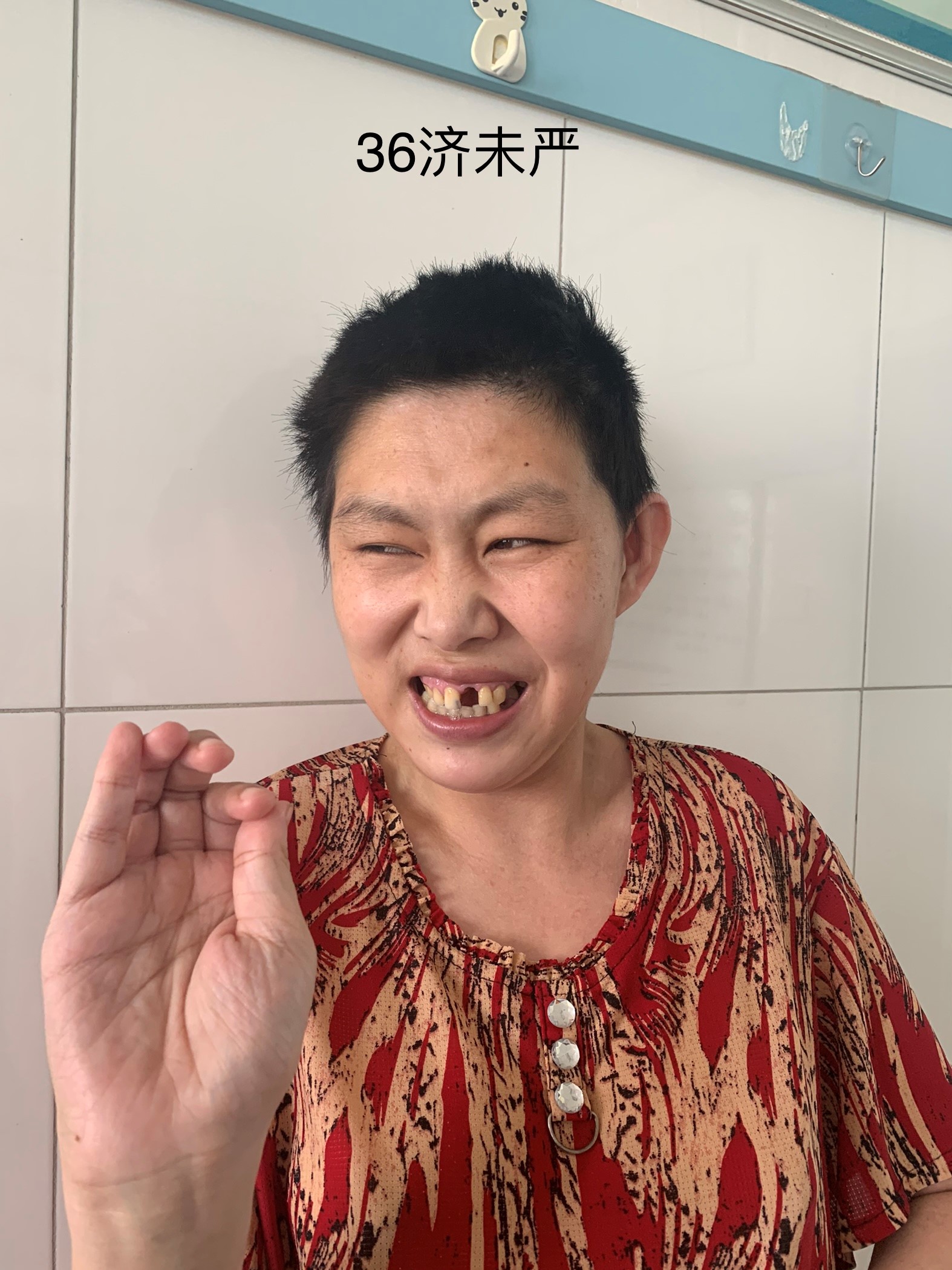 走失者照片 济南市寻亲：青年女子被救助，高1米...