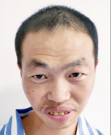 走失者照片 北京市寻亲：青年男子被救助，疑患智...