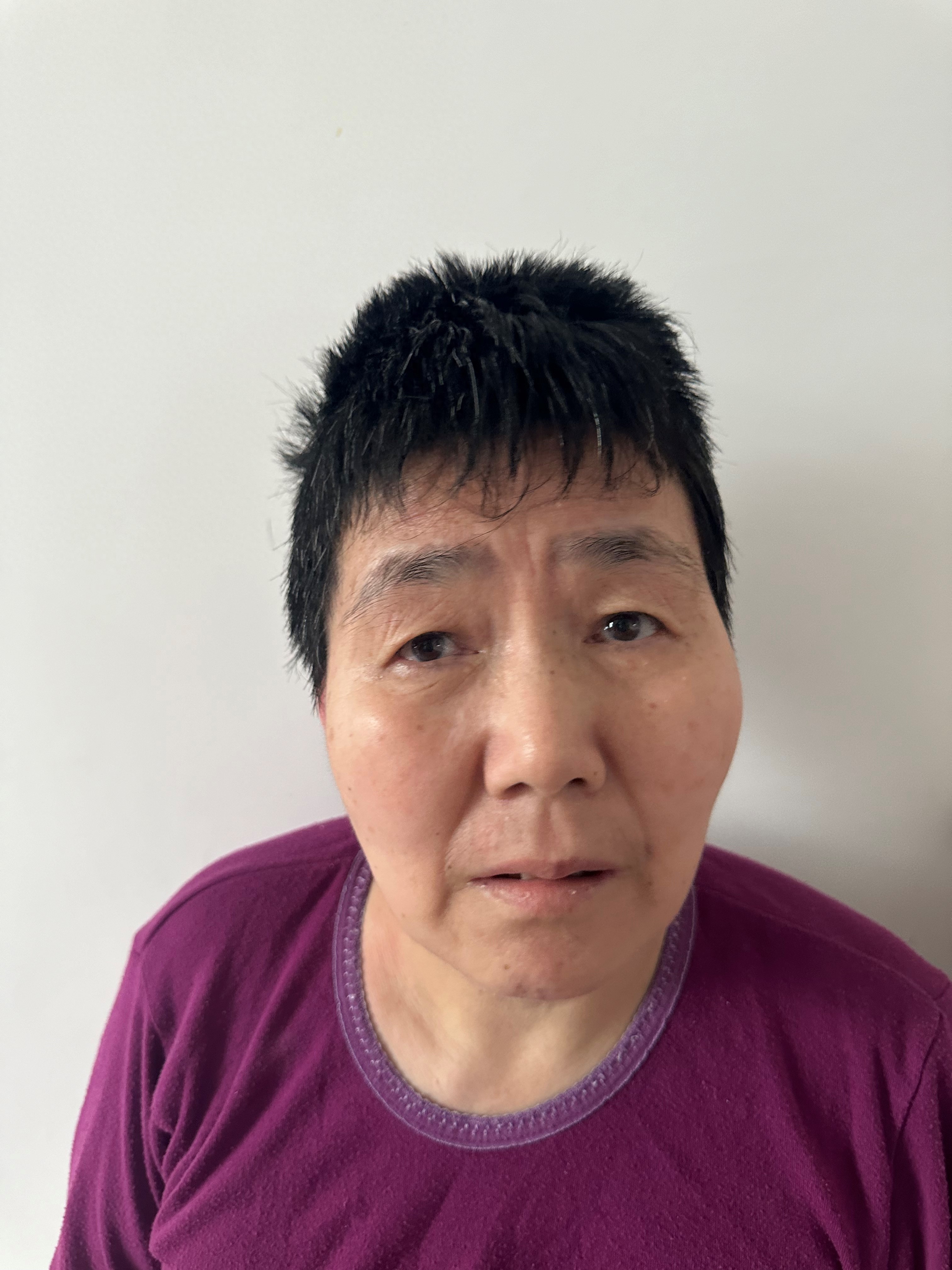 走失者照片 北京市寻亲：中年女子被救助，左侧胸...