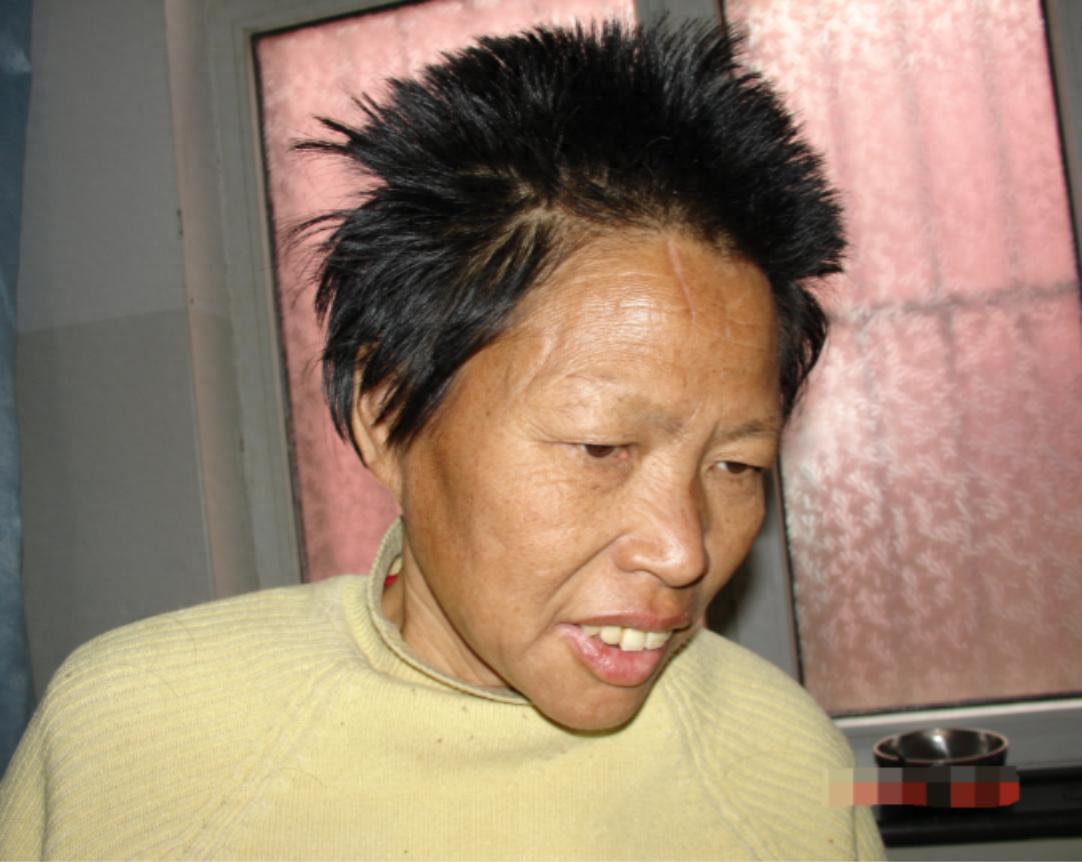 走失者照片 晋中市寻亲：五旬女子被救助多年，自...