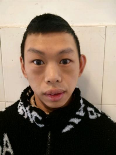 走失者照片 重庆市寻亲：青年男子被救助，疑患智...