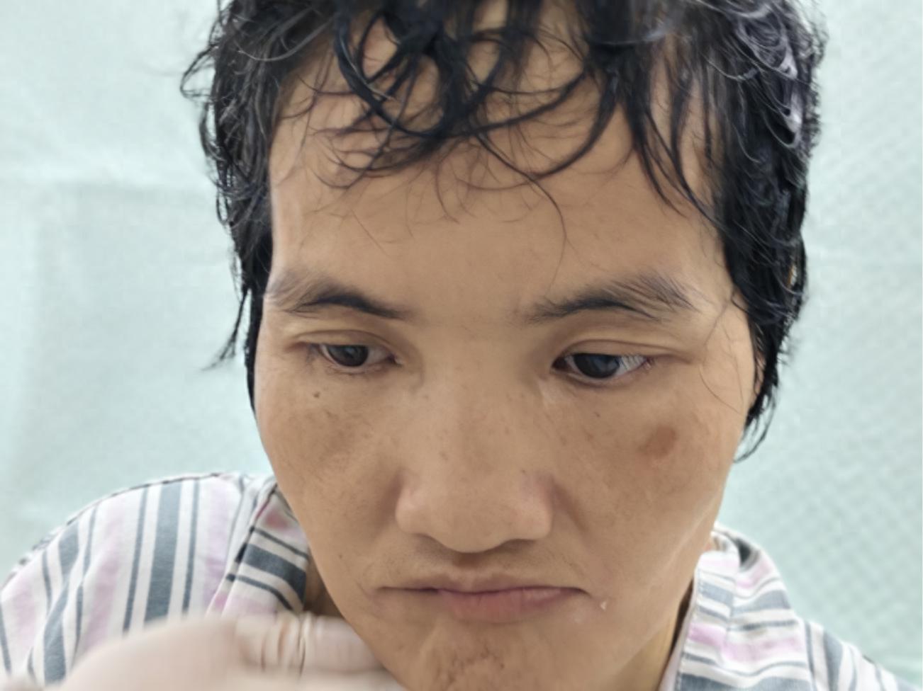 走失者照片 梧州市寻亲：中年女子被救助，疑患精...