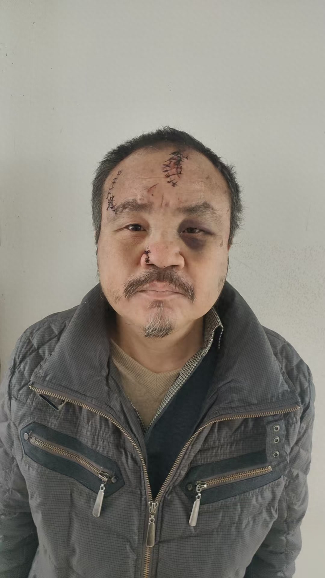 走失者照片 孝感市寻亲：五旬男子被救助，穿深色...