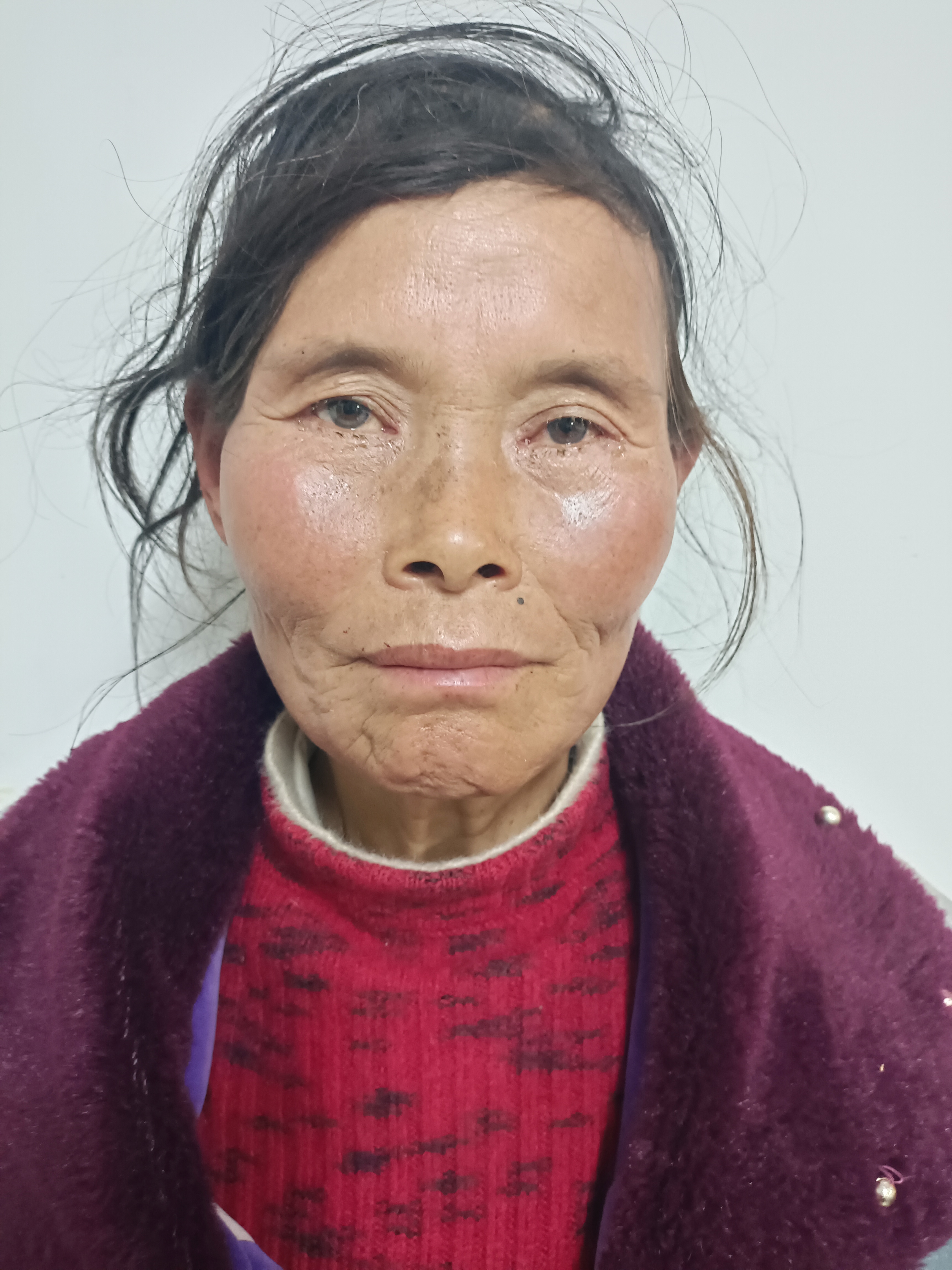 走失者照片 昭通市寻亲：六旬老太被救助，高1米...