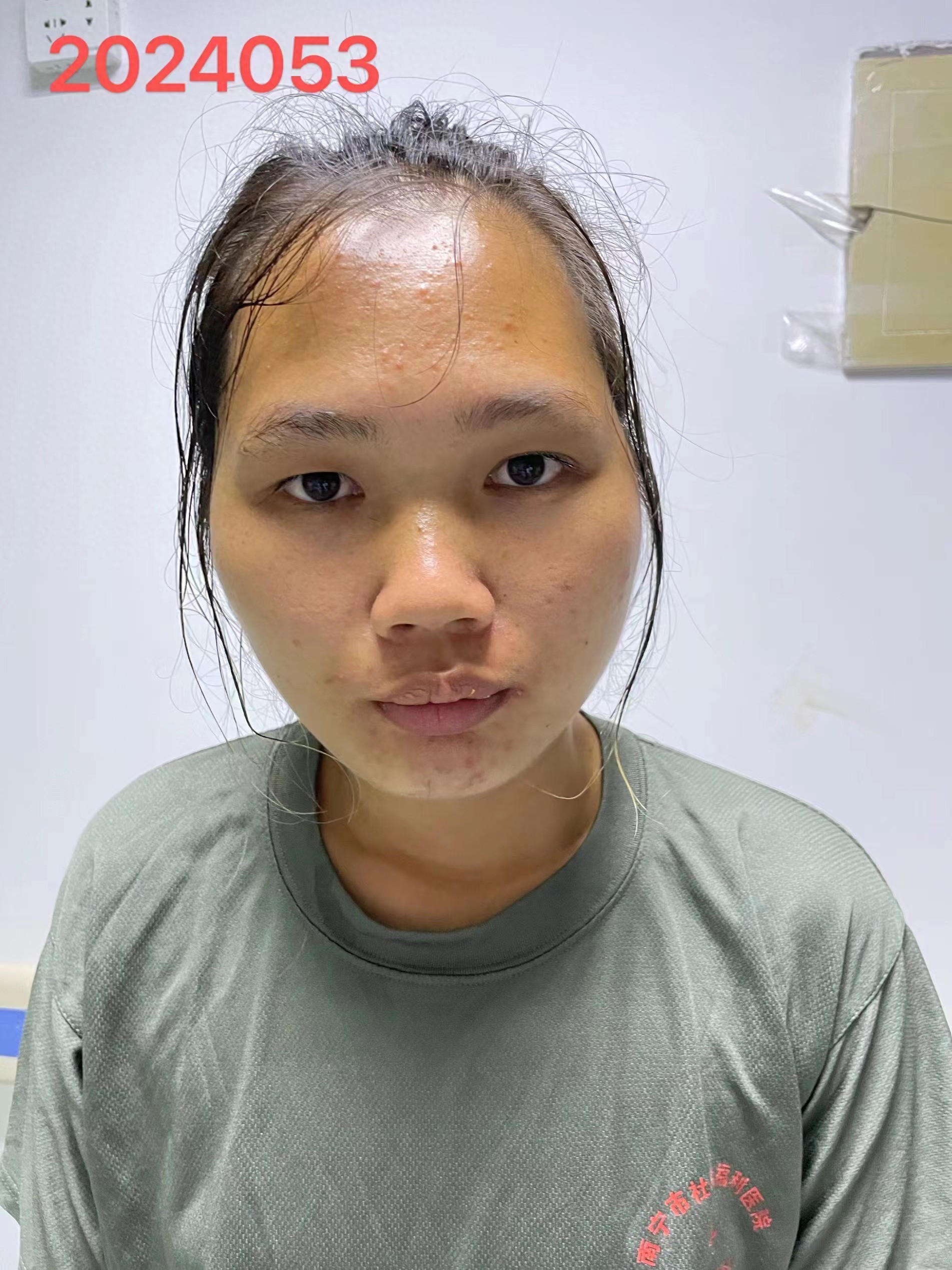 走失者照片 南宁市寻亲：青年女子被救助，扎马尾...