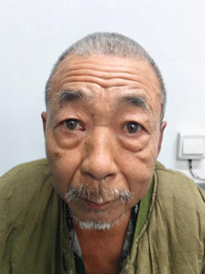 走失者照片 沈阳市新民市寻亲：七旬老人被救助，...