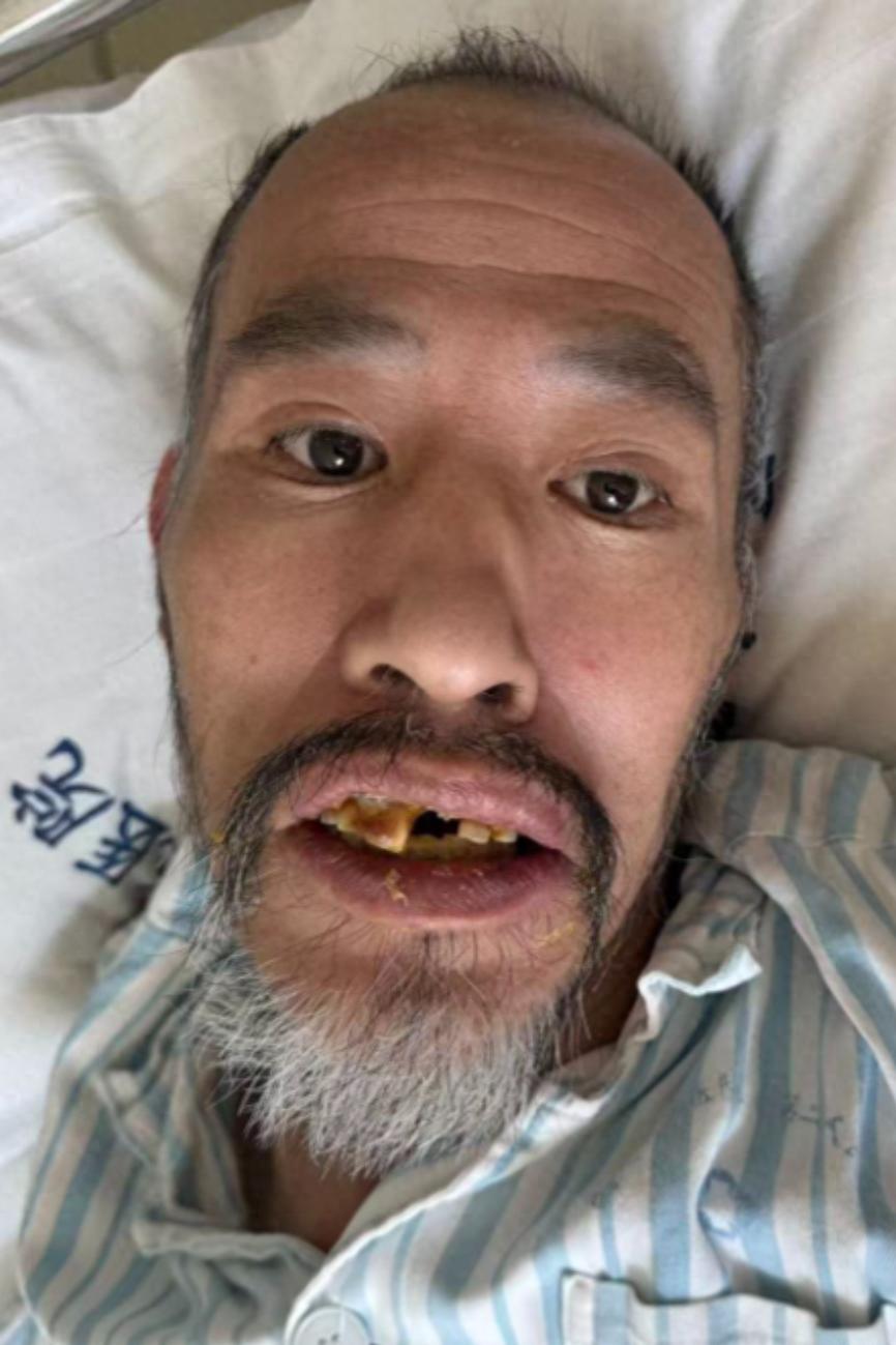 走失者照片 兰州市寻亲：五旬男子被救助，患语言...