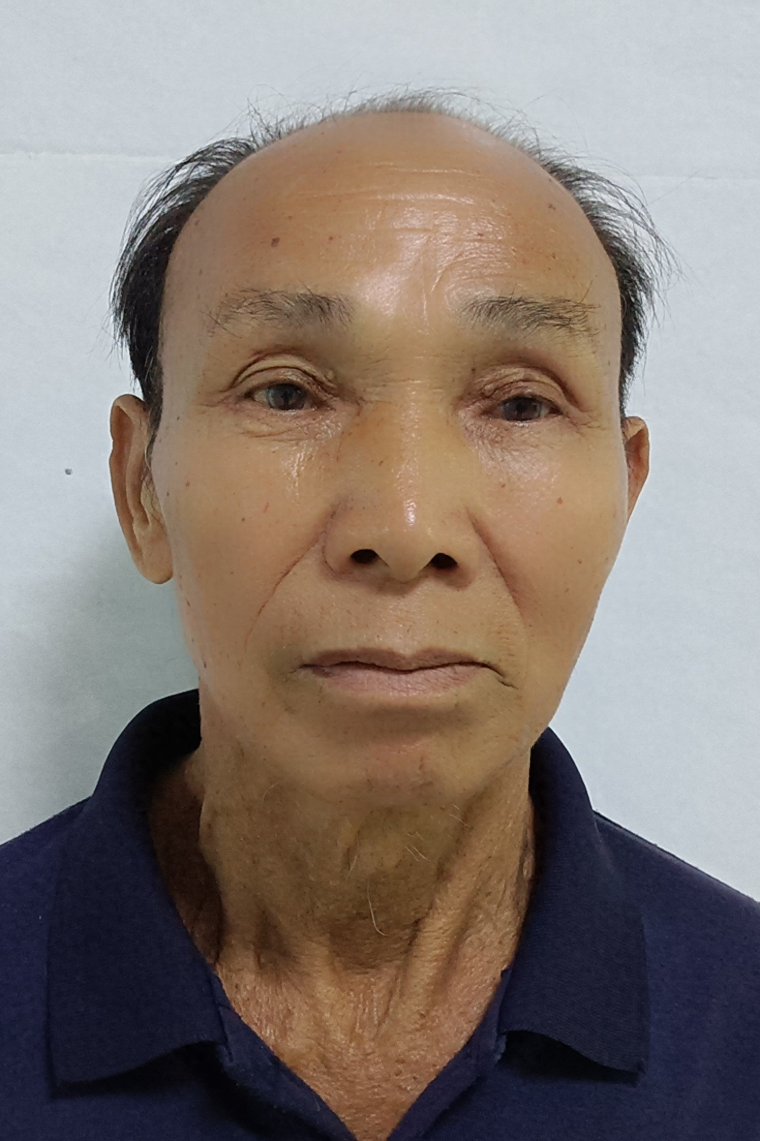 走失者照片 河池市寻亲：六旬老人被救助，自述叫...