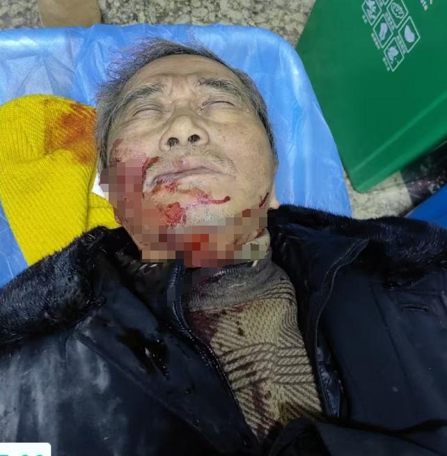 走失者照片 哈尔滨市寻亲：七旬老人被救助，穿蓝...