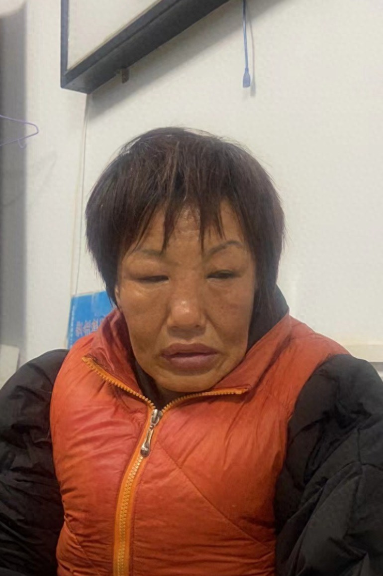 走失者照片 张家口市寻亲：五旬女子被救助，高1...