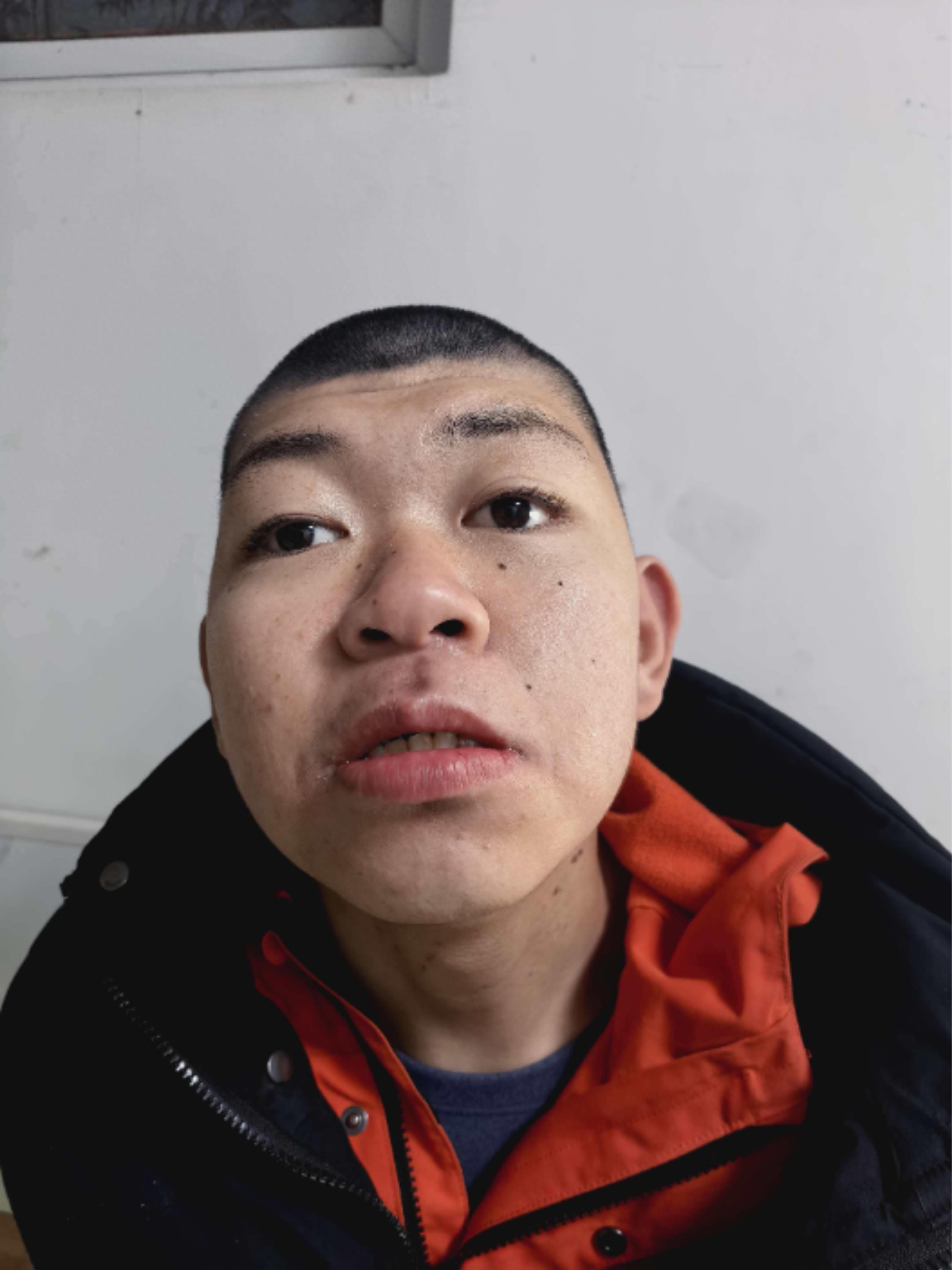 走失者照片 北京市寻亲：18岁男孩被救助，患智...