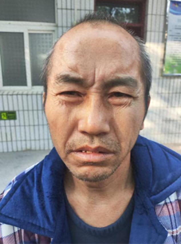 走失者照片 郑州市寻亲：中年男子被救助，自述叫...