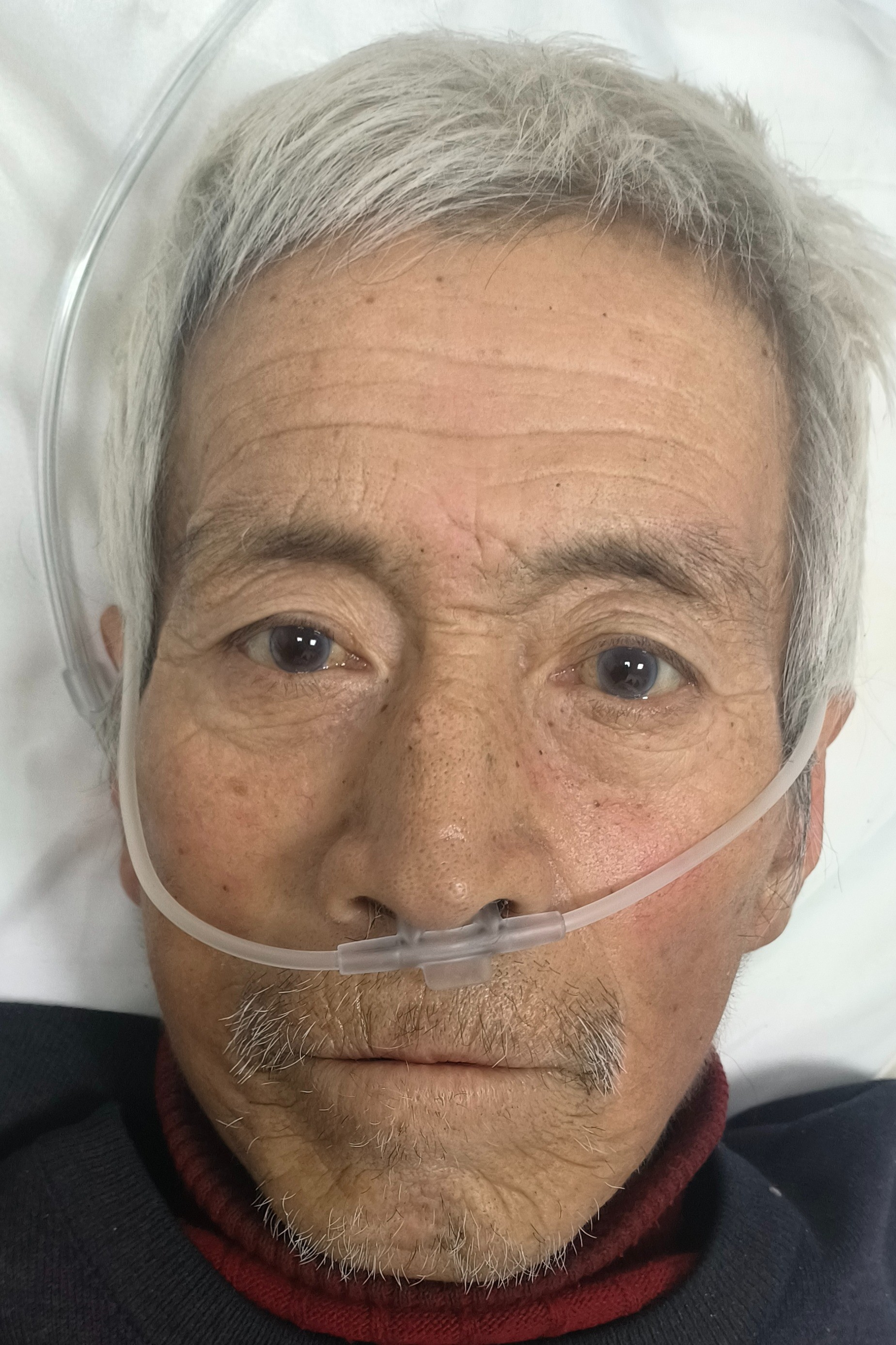 走失者照片 牡丹江市东宁市寻亲：七旬老人被救助...