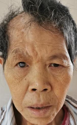 走失者照片 佛山市寻亲：中年女子被救助，疑似河...