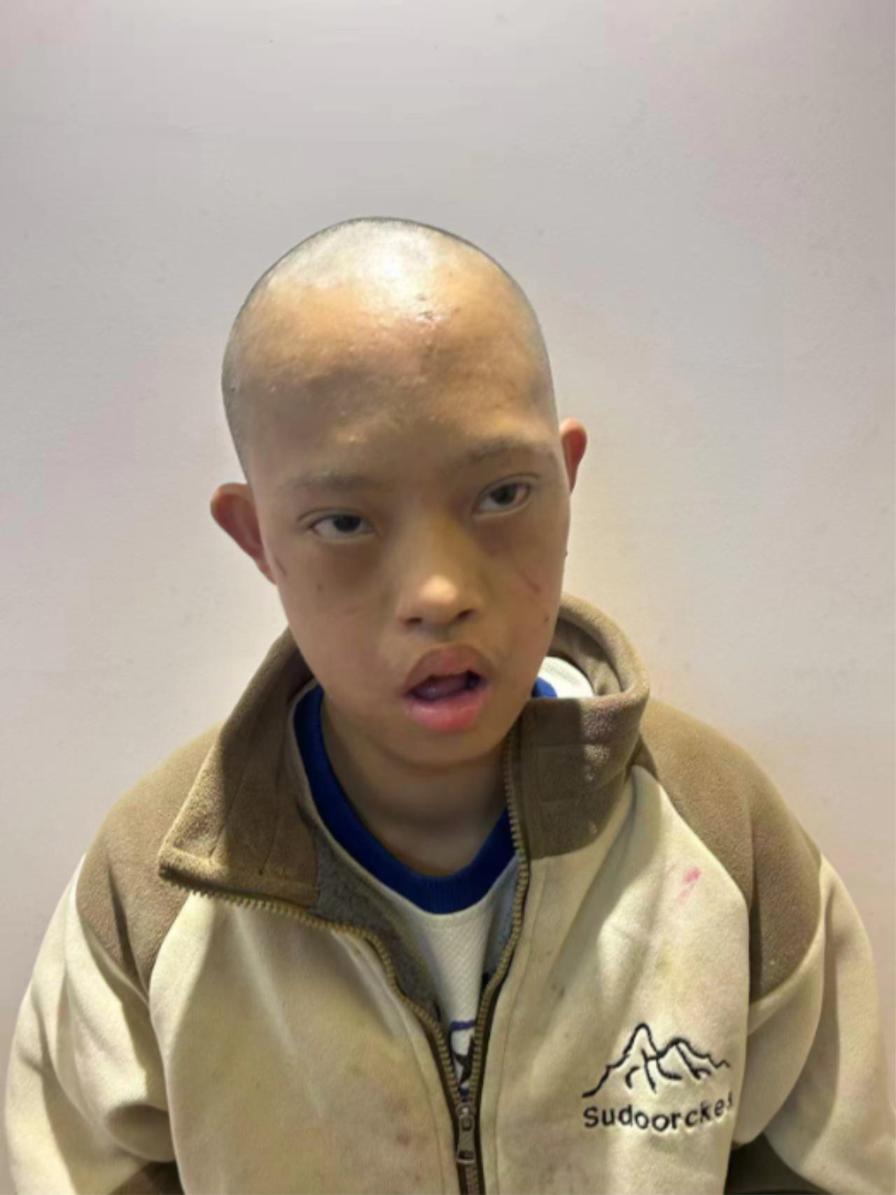 走失者照片 泉州市石狮市寻亲：15岁男孩被救助...