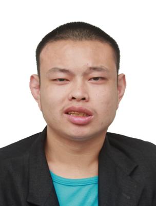 走失者照片 东莞市寻亲：青年男子被救助，自述叫...
