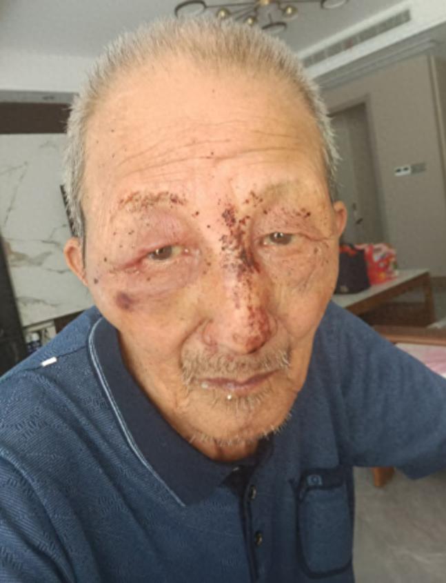 走失者照片 泰州市寻人：八旬老人走失，高约1米...