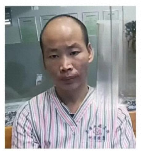 走失者照片 株洲市寻人：青年男子走失，智力异常...