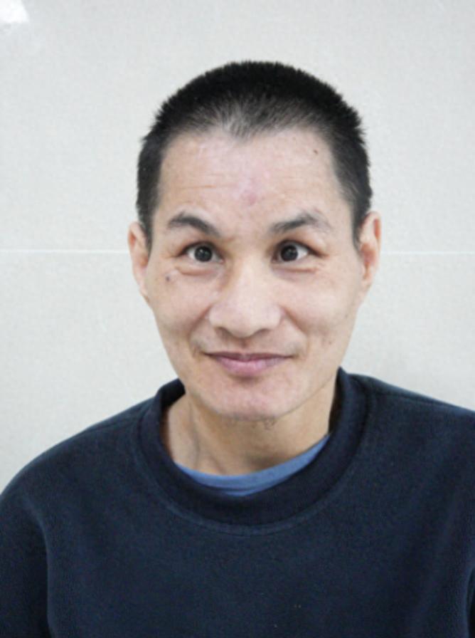 走失者照片 厦门市寻亲：中年男子被救助多年，疑...