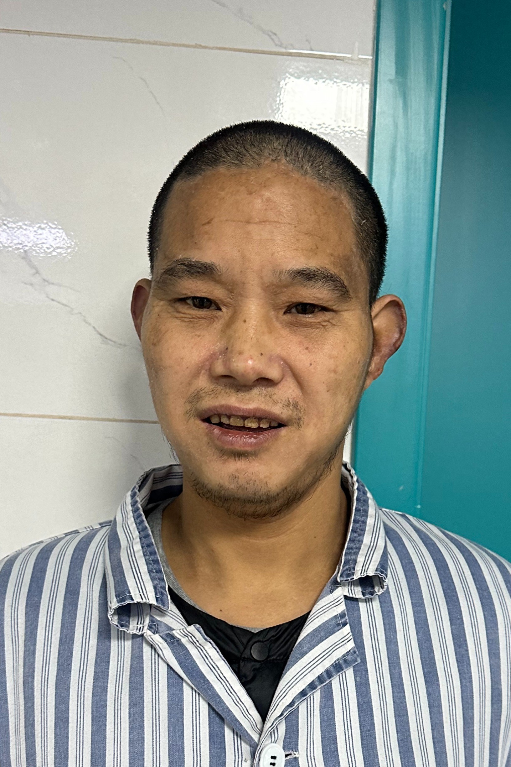 走失者照片 成都市寻亲：青年男子被救助，高1米...
