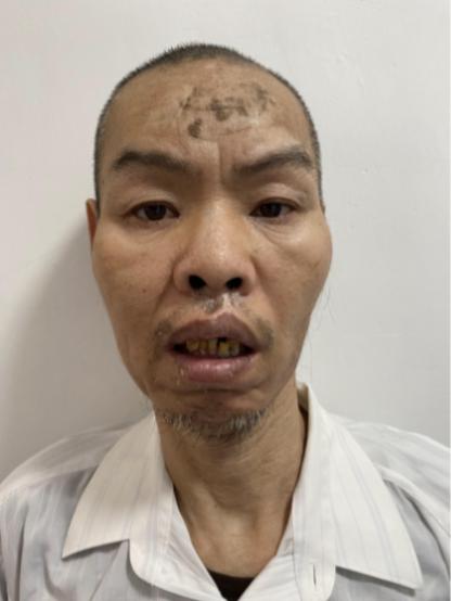 走失者照片 潮州市寻亲：五旬男子被救助，高1米...