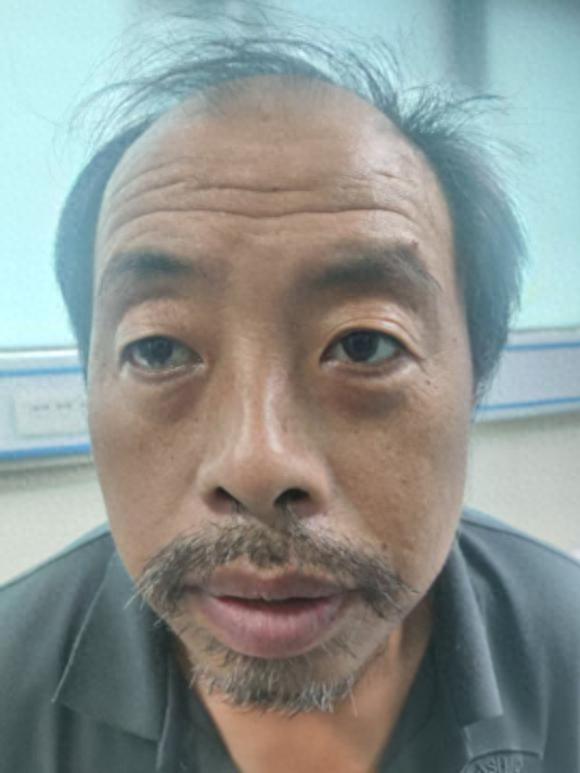 走失者照片 郑州市寻亲：五旬男子被救助，疑患智...