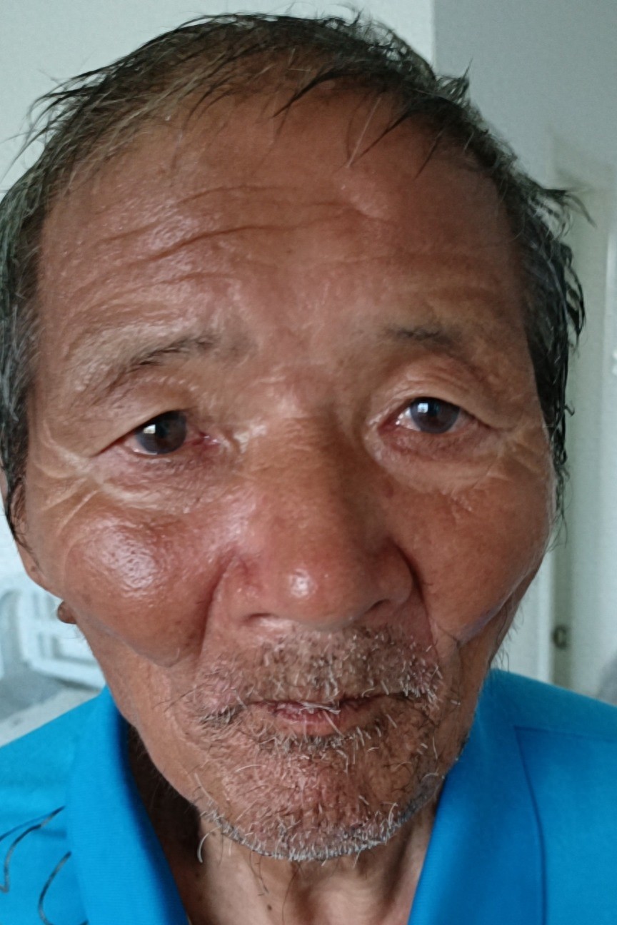 走失者照片 宿州市寻亲：六旬老人被救助，自述叫...