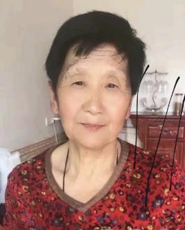 走失者照片 鹰潭市贵溪市寻人：七旬老太走失，穿...