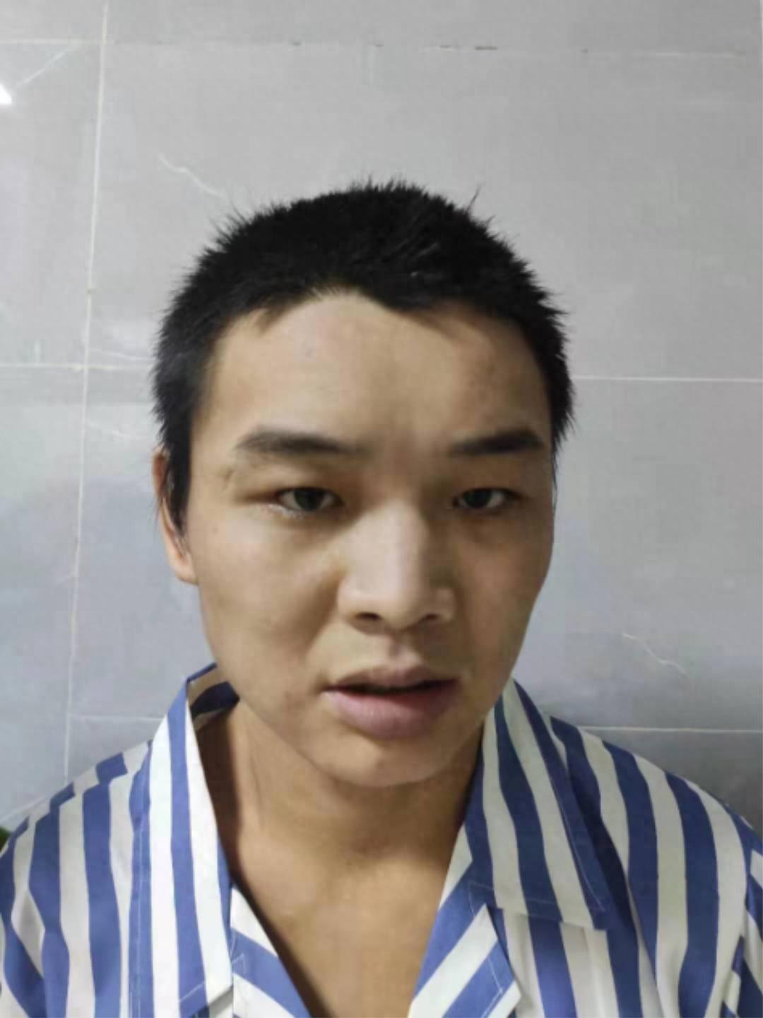 走失者照片 北京市寻亲：青年男子被救助，疑患精...