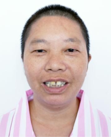 走失者照片 北京市寻亲：五旬女子被救助，疑似名...