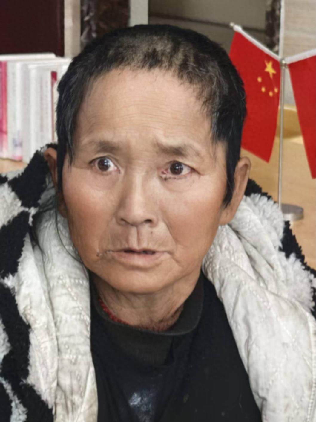 走失者照片 抚州市寻亲：六旬老太被救助，穿黑白...