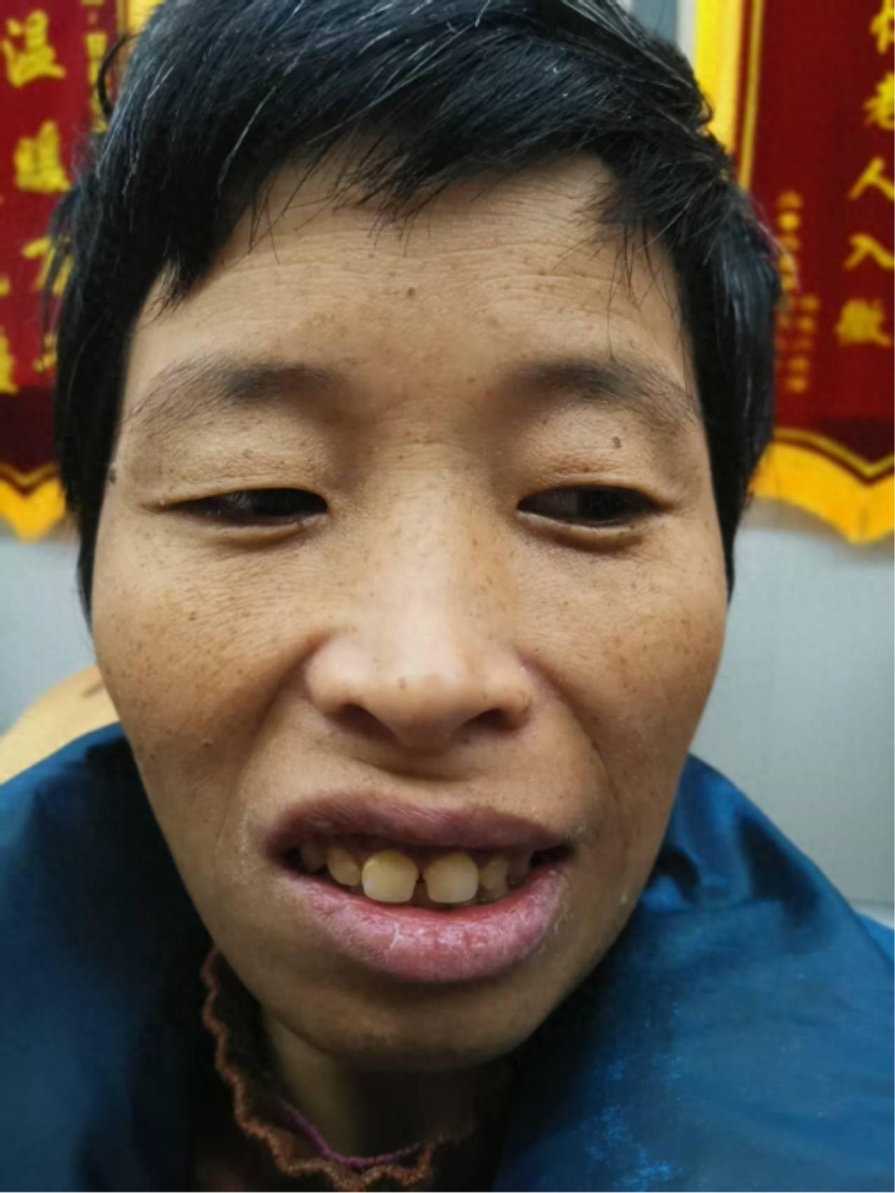 走失者照片 漯河市寻亲：中年女子被救助，疑似精...