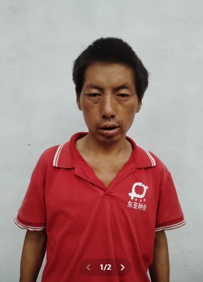 走失者照片 亳州市寻人：中年男子走失，患精神障...