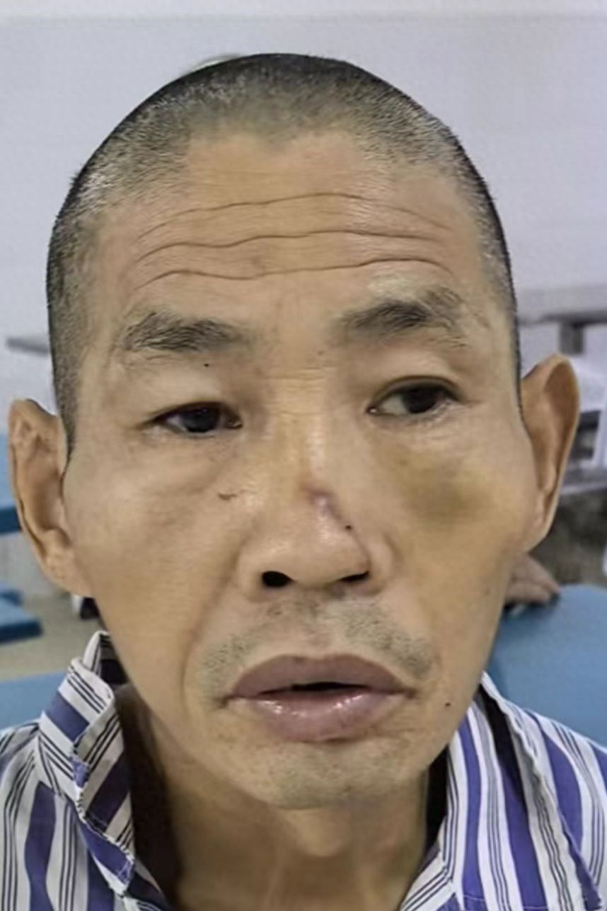 走失者照片 玉林市寻亲：中年男子被救助，穿蓝白...