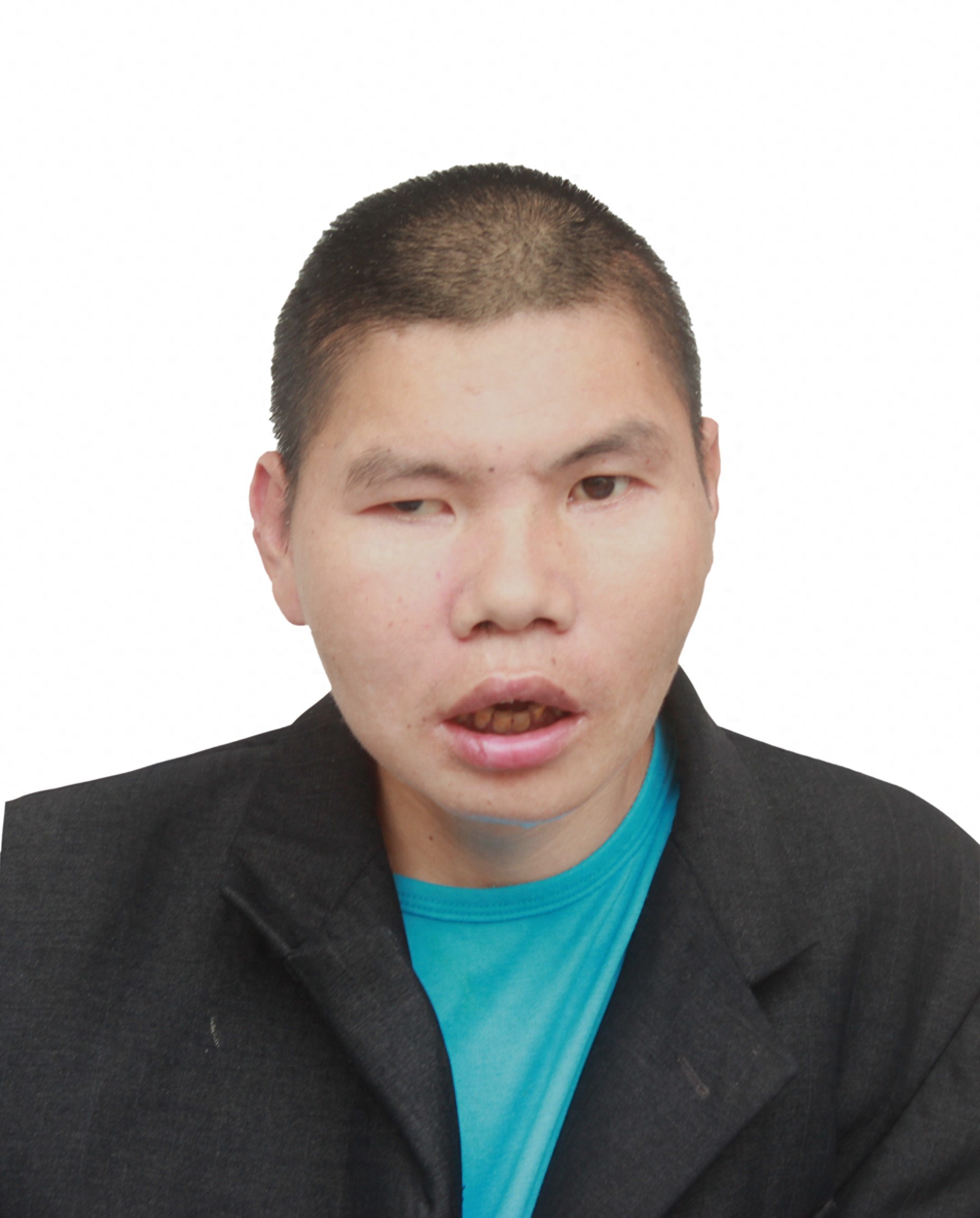 走失者照片 东莞市寻亲：青年男子被救助，自述姓...