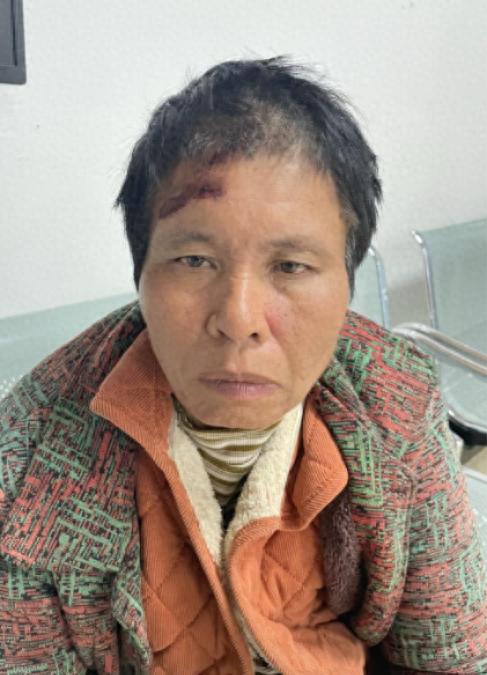 走失者照片 清远市寻亲：五旬女子被救助，高1米...