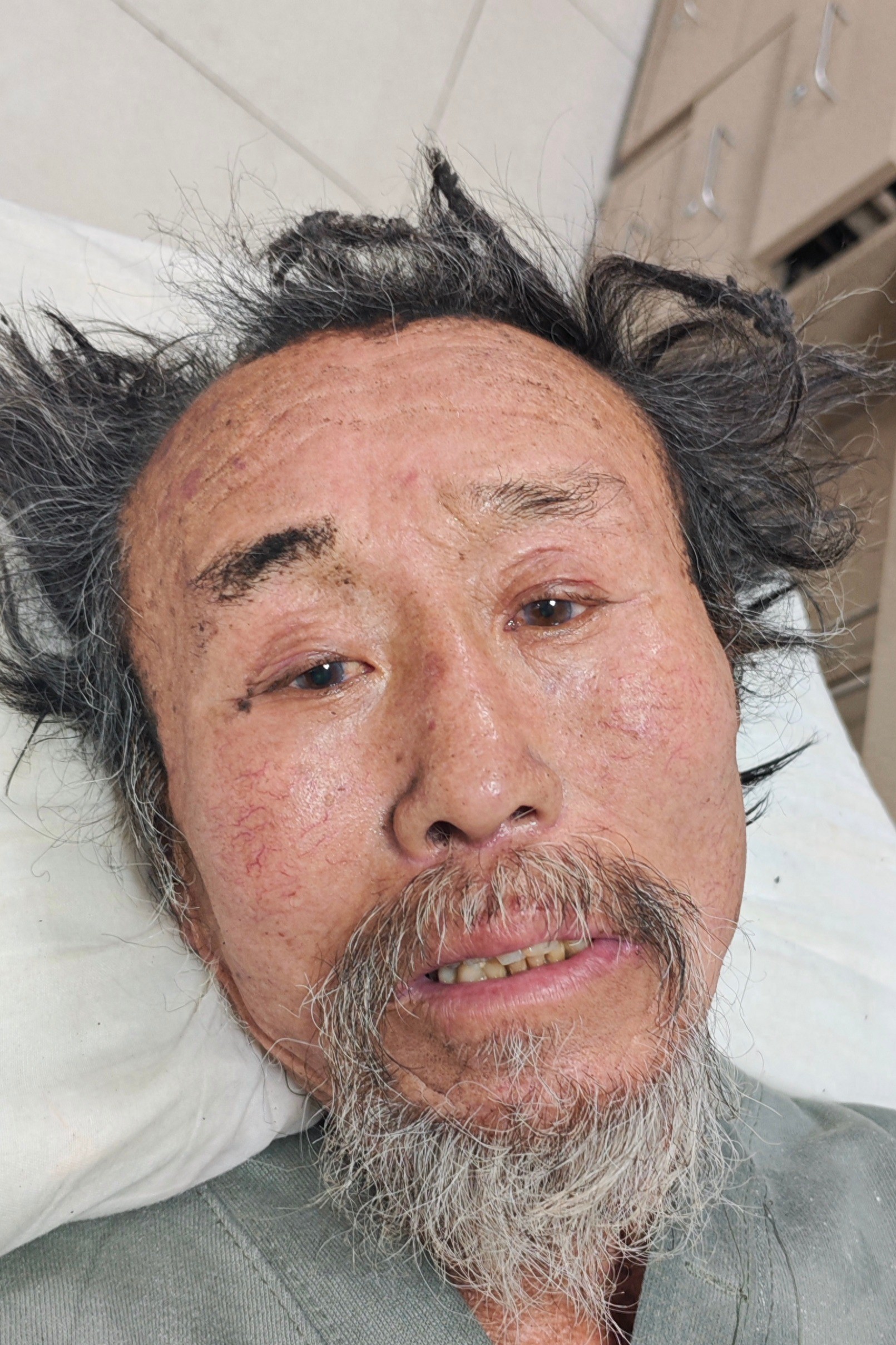 走失者照片 鸡西市寻亲：七旬老人被救助，自述叫...