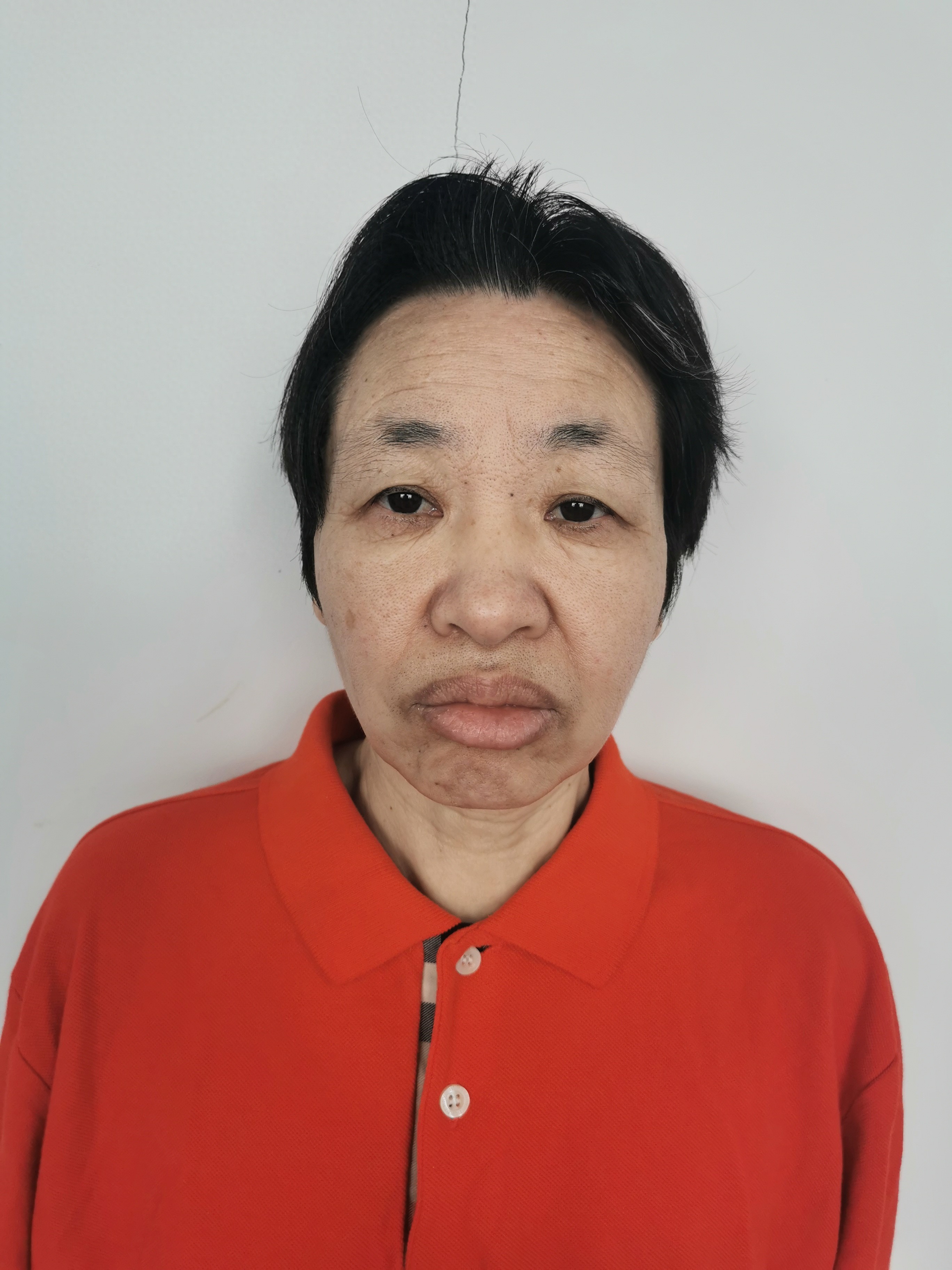 走失者照片 北京市寻亲：中年女子被救助，高1米...