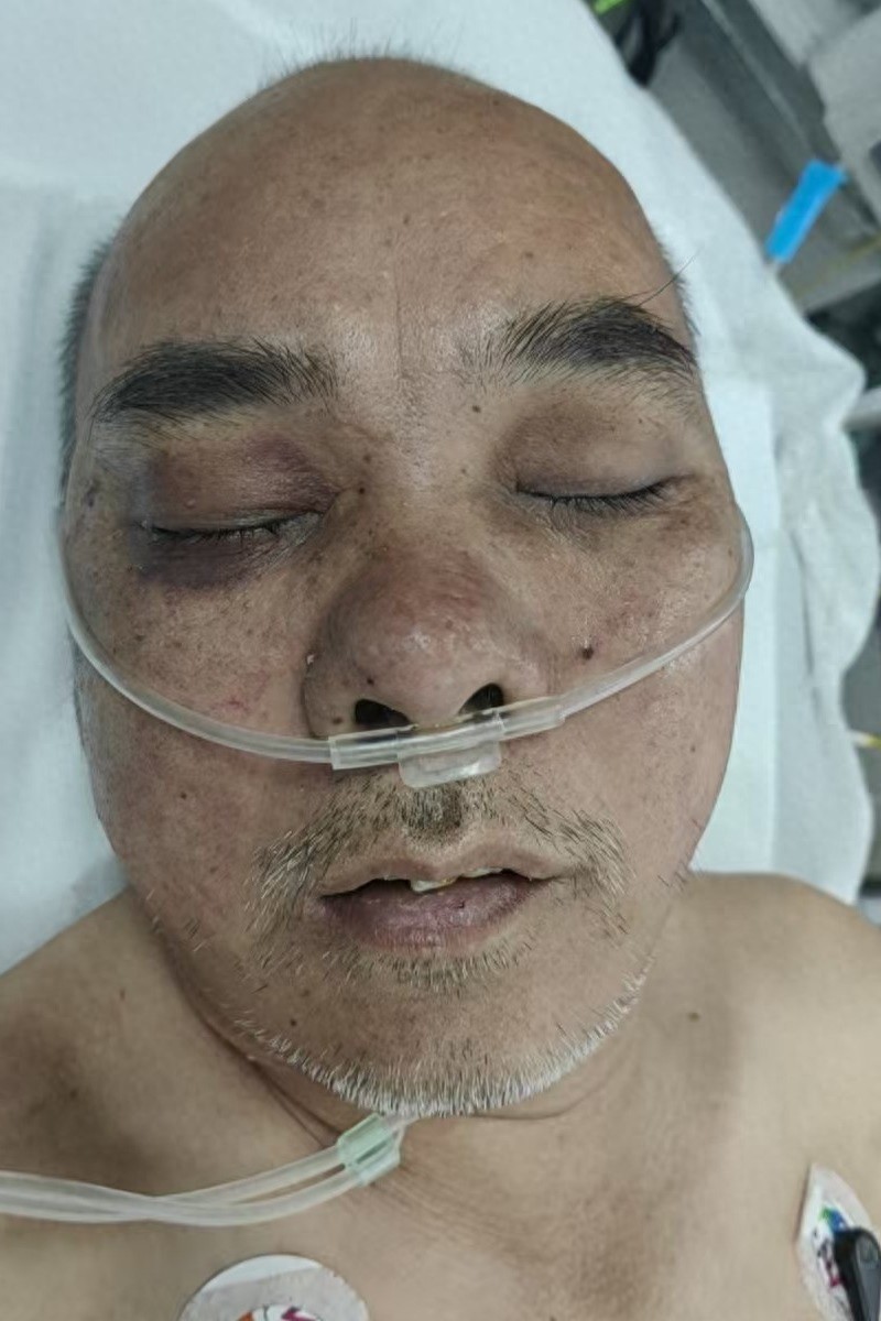 走失者照片 海口市寻亲：中年男子被救助，高1米...