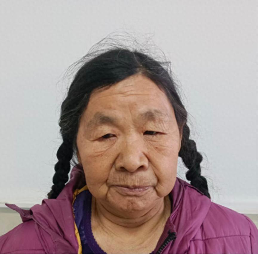 走失者照片 十堰市寻亲：七旬老太被救助，疑患智...