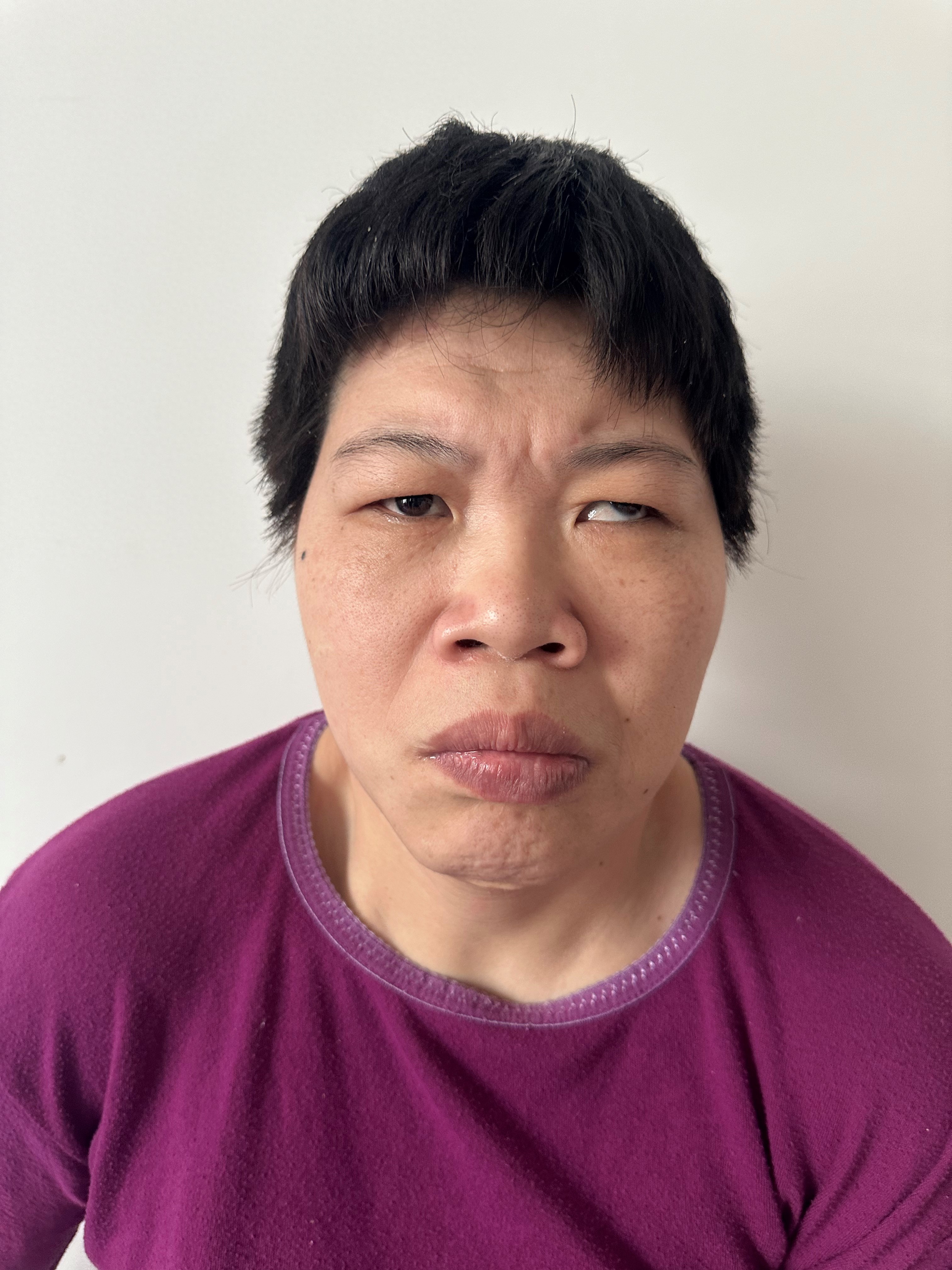 走失者照片 北京市寻亲：青年女子被救助，左上肢...
