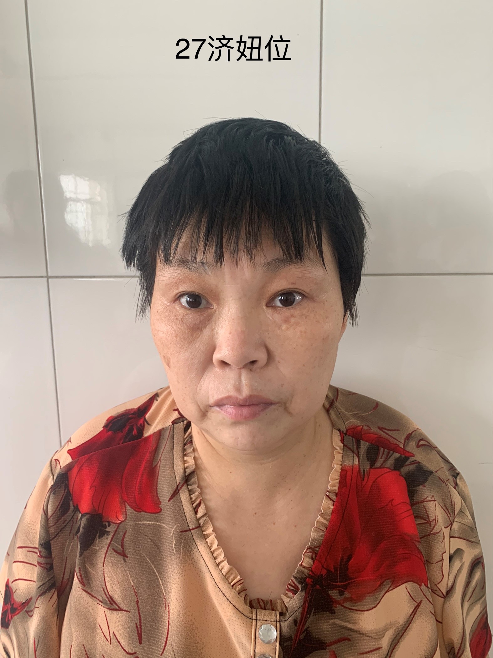 走失者照片 济南市寻亲：五旬女子被救助，自述叫...
